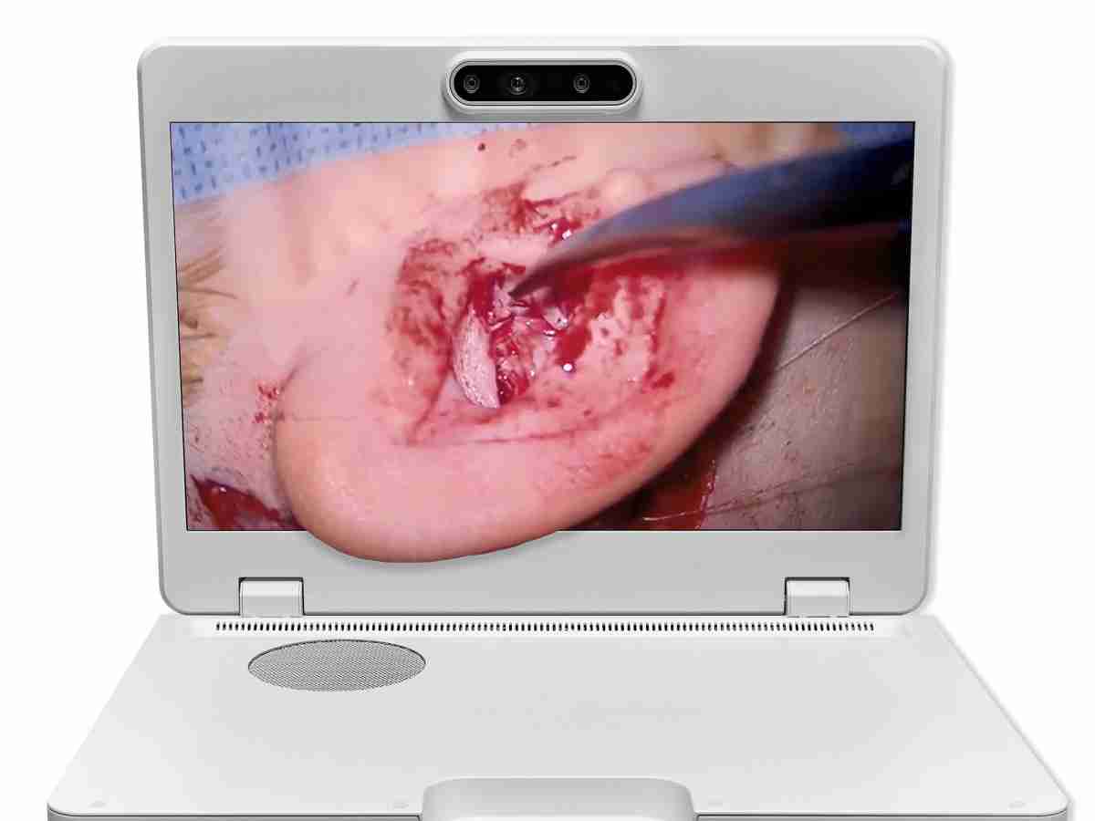 达擎之＂Heads-up 3D显微手术显示系统＂，，整合4K裸眼3D显示及眼球追踪系统，，，，具备快速追踪人眼移动位置功能，，，减轻医师长时间维持固定姿势的负担，，，，让医师能有更宽广清晰的3D立体视野及更舒适的姿势来执行手术。。。。